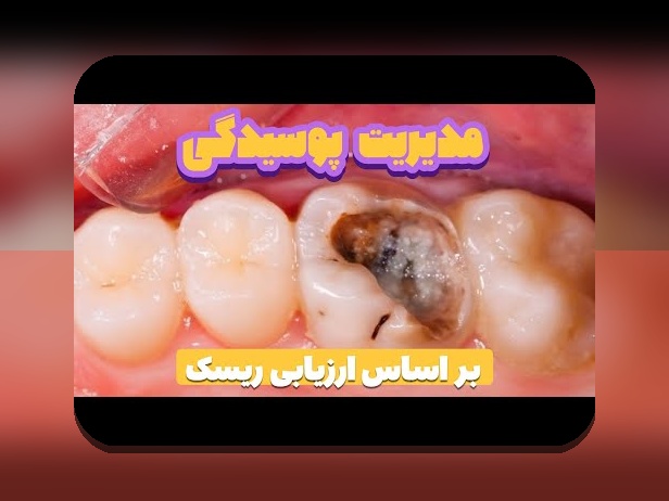 درک آنچه باید درباره تحلیل ریسک ساده زندگی بدانید: راهنمای جامع برای آرامش و امنیت شما